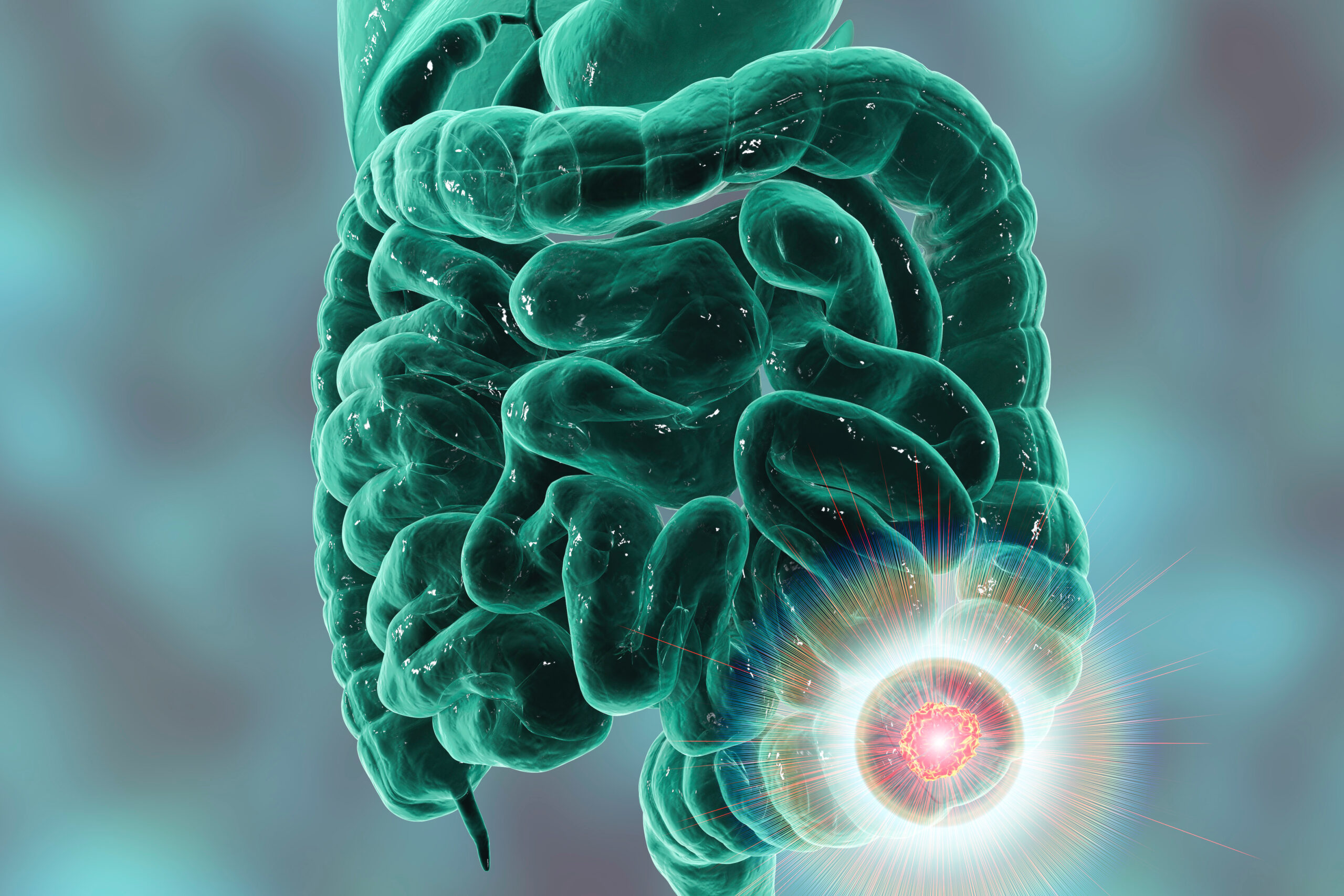 circulating-tumor-cells-in-right-and-left-sided-colorectal-cancer